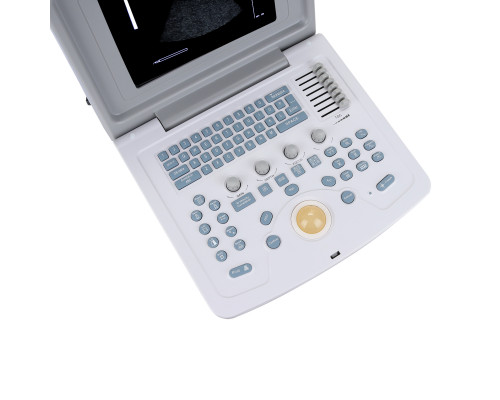 УЗИ сканер CMS600B3